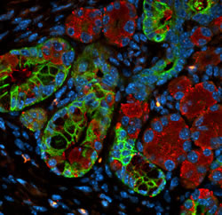 Gene linked to pancreatic cancer growth, U-M study finds